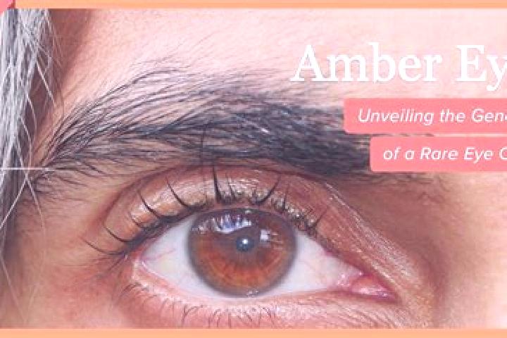 Addison, 29, a black amber-eyed caribbean companion based in Valmontone. Offering Domination, GFE, CIM. Available for incall and outcall, day and evening dates.