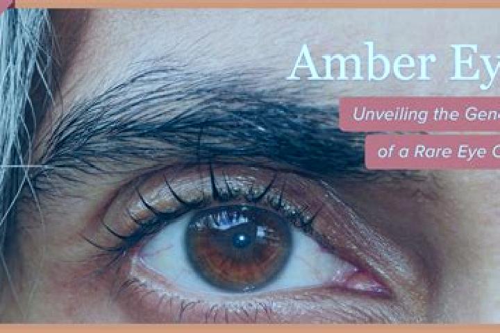 Addison, 31, a red amber-eyed mediterranean companion based in Fraga. Offering Girlfriend Experience, Dinner Date, Striptease, Domination, Tantra. Available ...