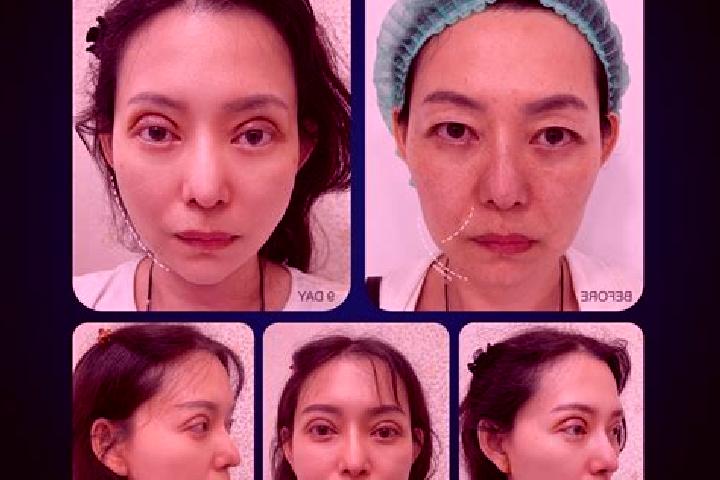 Alice, 39 — Escort in Tianwan, China