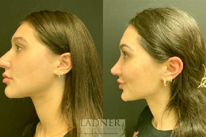 Aubrey, 28 — Escort in Akarcay, Turkey