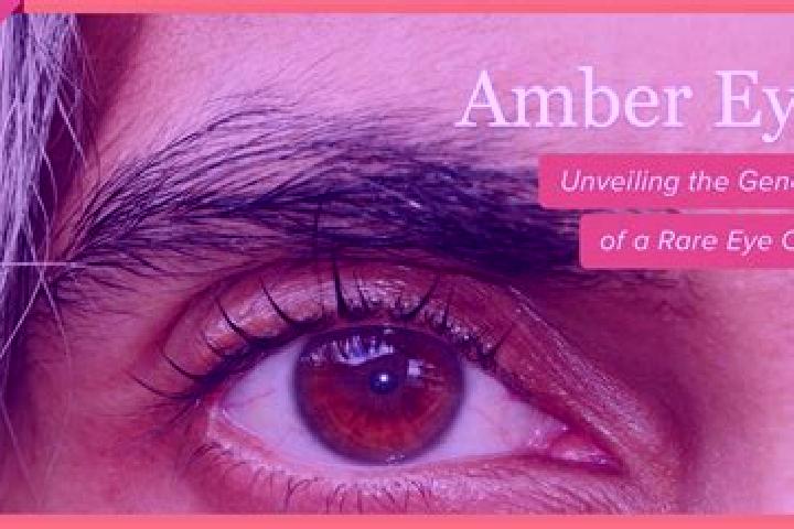 Chloe, 22, a black amber-eyed middle eastern companion based in Fahrweid (suedl. Teil). Offering Couples, Massage, Roleplay. Available for incall and outcall...