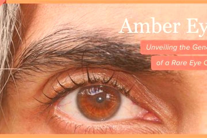 Emily, 20, a black amber-eyed slavic companion based in Mackinnon Road. Offering Fetish, Domination, A-Level, Tantra, Dinner Date. Available for incall and o...
