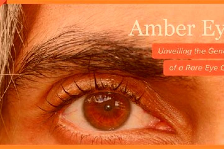 Emma, 22, a red amber-eyed ebony companion based in Dedelstorf. Offering Travel Companion, Striptease, Duos, GFE, Prostate Massage. Available for incall and ...