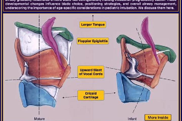 escort Airway Heights
