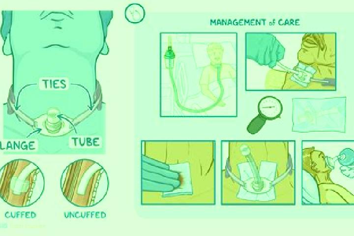 escort An Trach