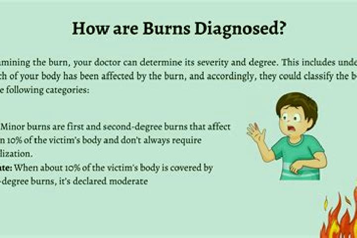 escort Burns