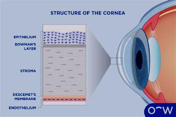escort Cornea