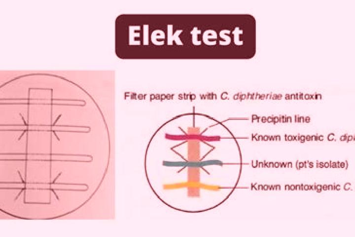 escort Elek