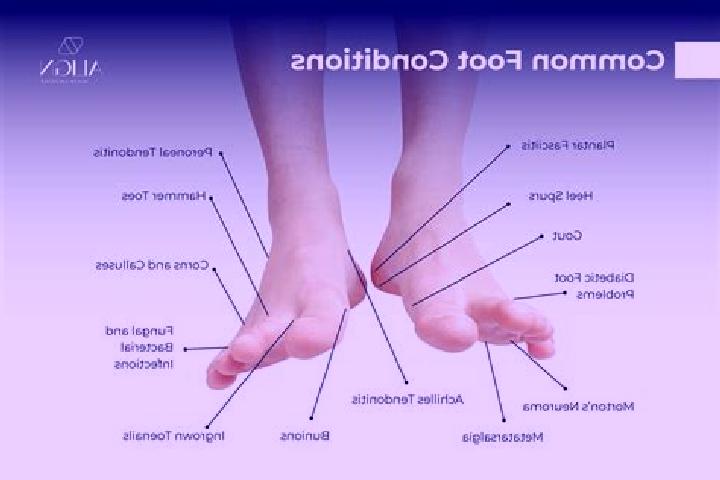 escort Foot of Ten