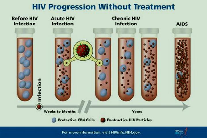escort Hiv