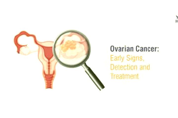 escort Ovari Paravarnattam