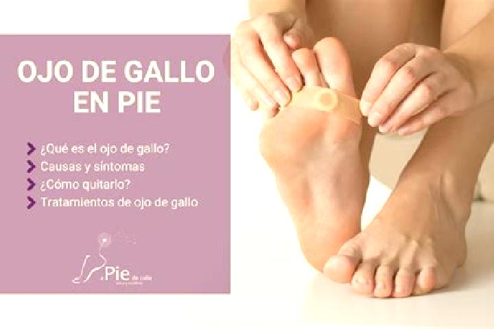 escort Pie de Gallo