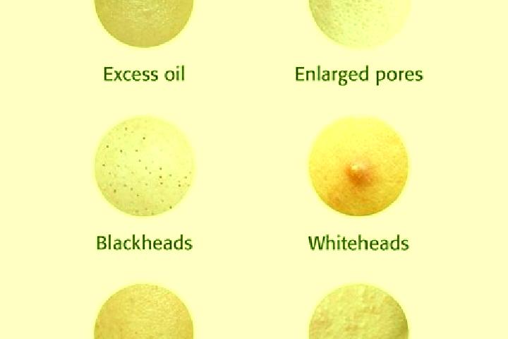 escort Pore