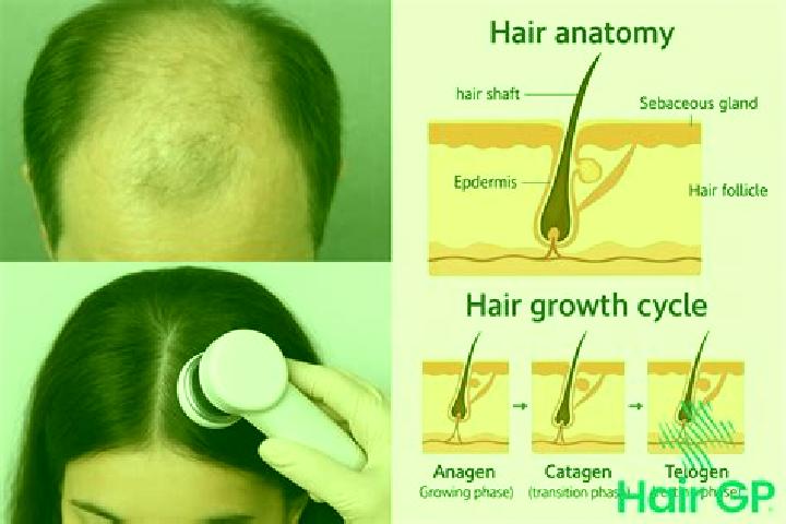 escort Scalp Level