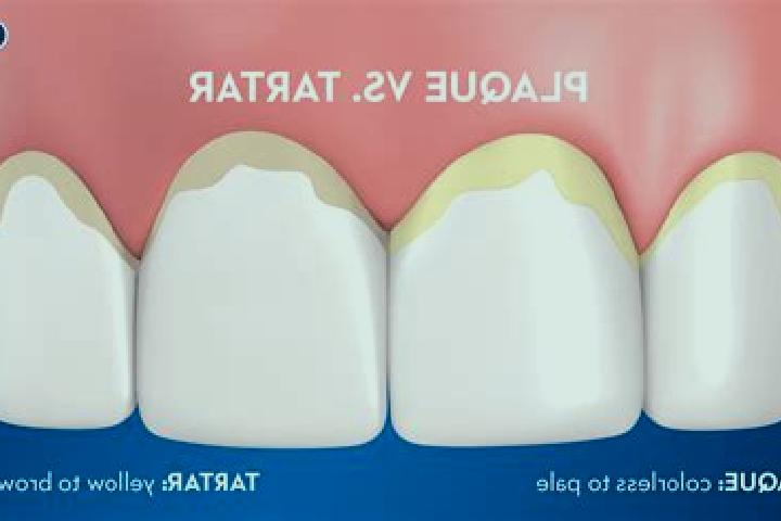 escort Tartar