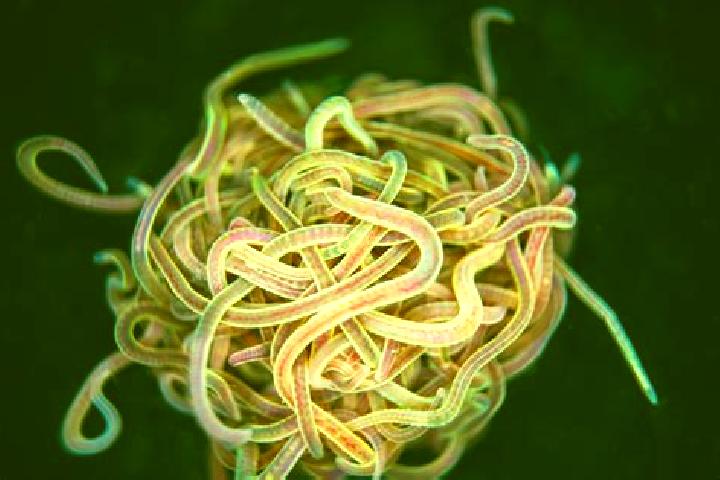 escort Worms