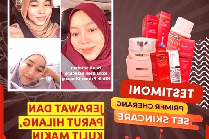 Escorts Cherang Ruku, Malaysia — Local Companions