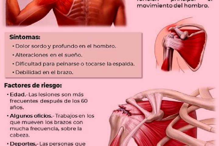Escorts El Manguito, Mexico — Local Companions