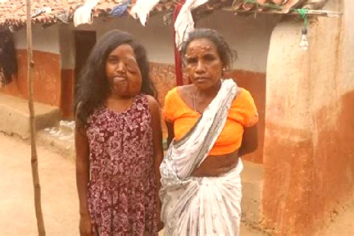 Escorts Jadugora, India — Local Companions