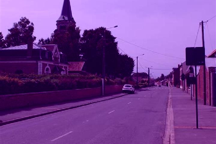 Escorts Neuville-Vitasse, France — Local Companions