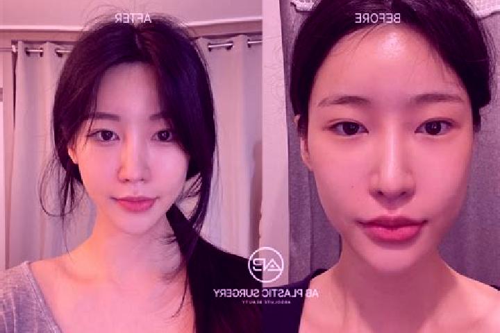 Grace, 38 — Escort in Kowon-up, North Korea