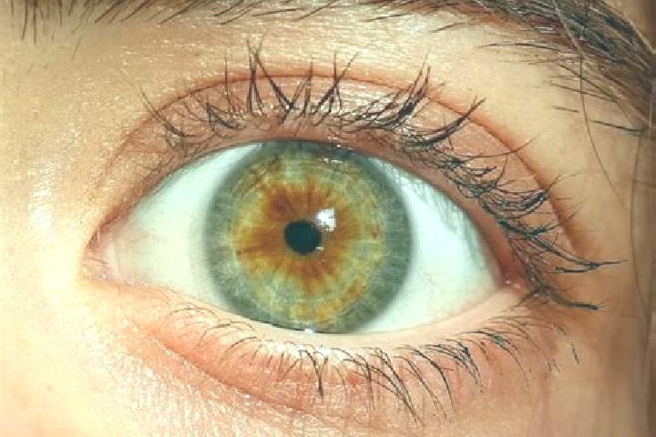 Iris, 21, a red hazel-eyed slavic companion based in Au. Offering 69, Fetish, Overnight, Domination. Available for incall and outcall, overnight bookings ava...