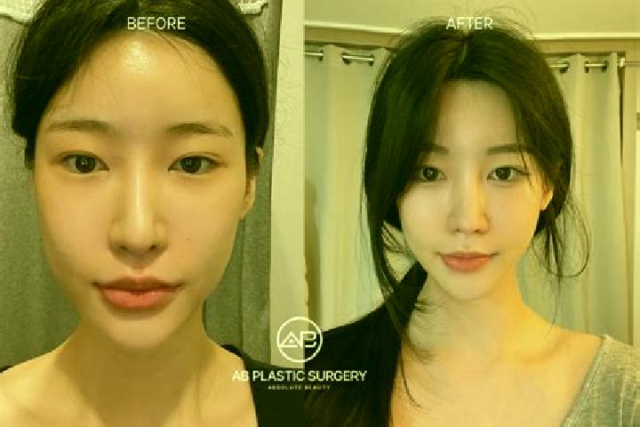 Ivy, 26 — Escort in Kowon-up, North Korea