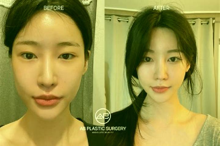 Jade, 22 — Escort in Kowon-up, North Korea