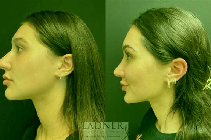 Madison, 26 — Escort in Akarcay, Turkey