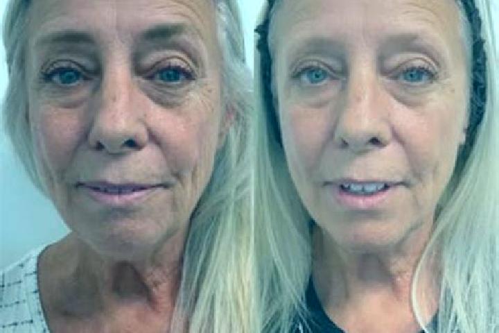 Madison, 35, a blonde grey-eyed slavic companion based in Pingelly. Offering A-Level, Striptease, Party Girl, Couples. Available for incall and outcall, day ...