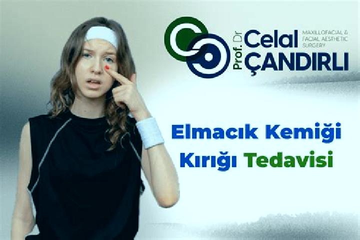Maya, 35 — Escort in Elmacik, Turkey