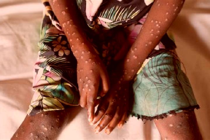 Nora, 26 — Escort in Maua, Kenya