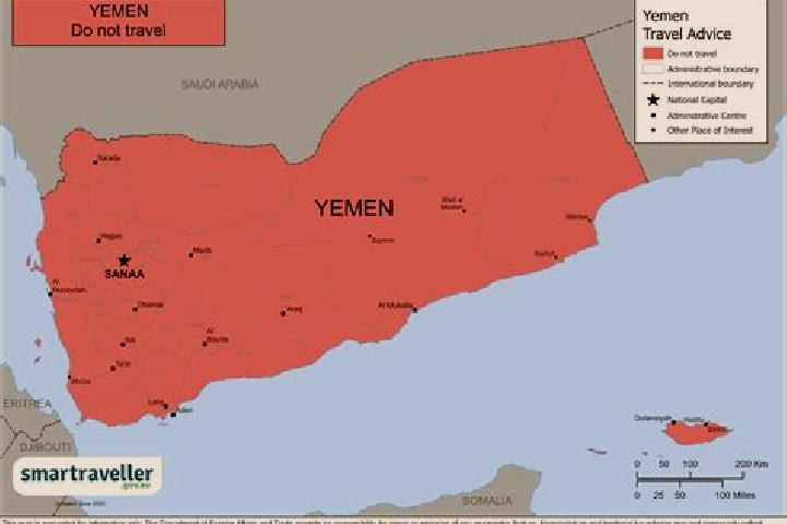 Riley, 31 — Escort in Matwah, Yemen