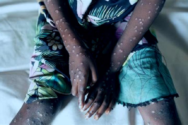 Sadie, 21 — Escort in Maua, Kenya