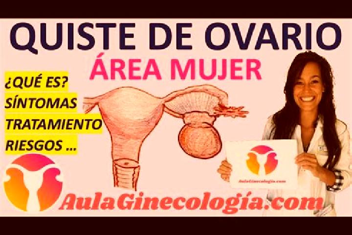 Zoey, 20 — Escort in Hoyos de Miguel Munoz, Spain